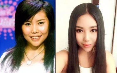 ​纪敏佳整容，歌手纪敏佳简介(纪敏佳个人资料简介)