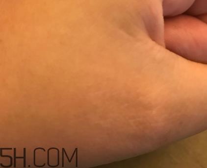 芳丹薄罗眼膜怎么用？芳丹薄罗眼膜要洗吗