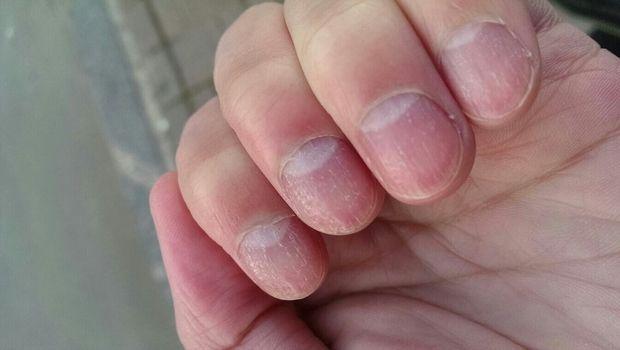 中医：成年人指甲长成这几种样子，说明你身体状态，真的出问题了