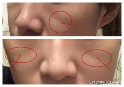 ​印第安纹是哪里（印第安纹是怎么形成的）